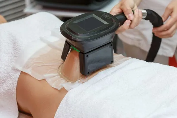 Image of person having fat freezing treatment to help weight gain Renfrew