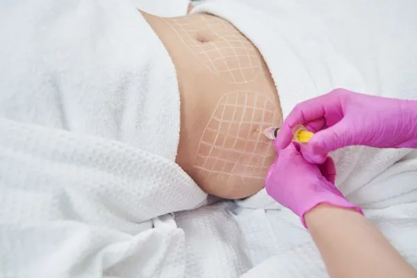 image of fat dissolving injections on love handles to help combat weight gain Renfrew